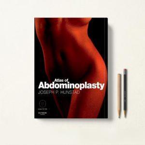 اطلس ابدومینوپلاستی Atlas of Abdominoplasty
