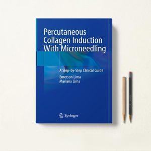 القای کلاژن از راه پوست با میکرونیدلینگ Percutaneous Collagen Induction With Microneedling